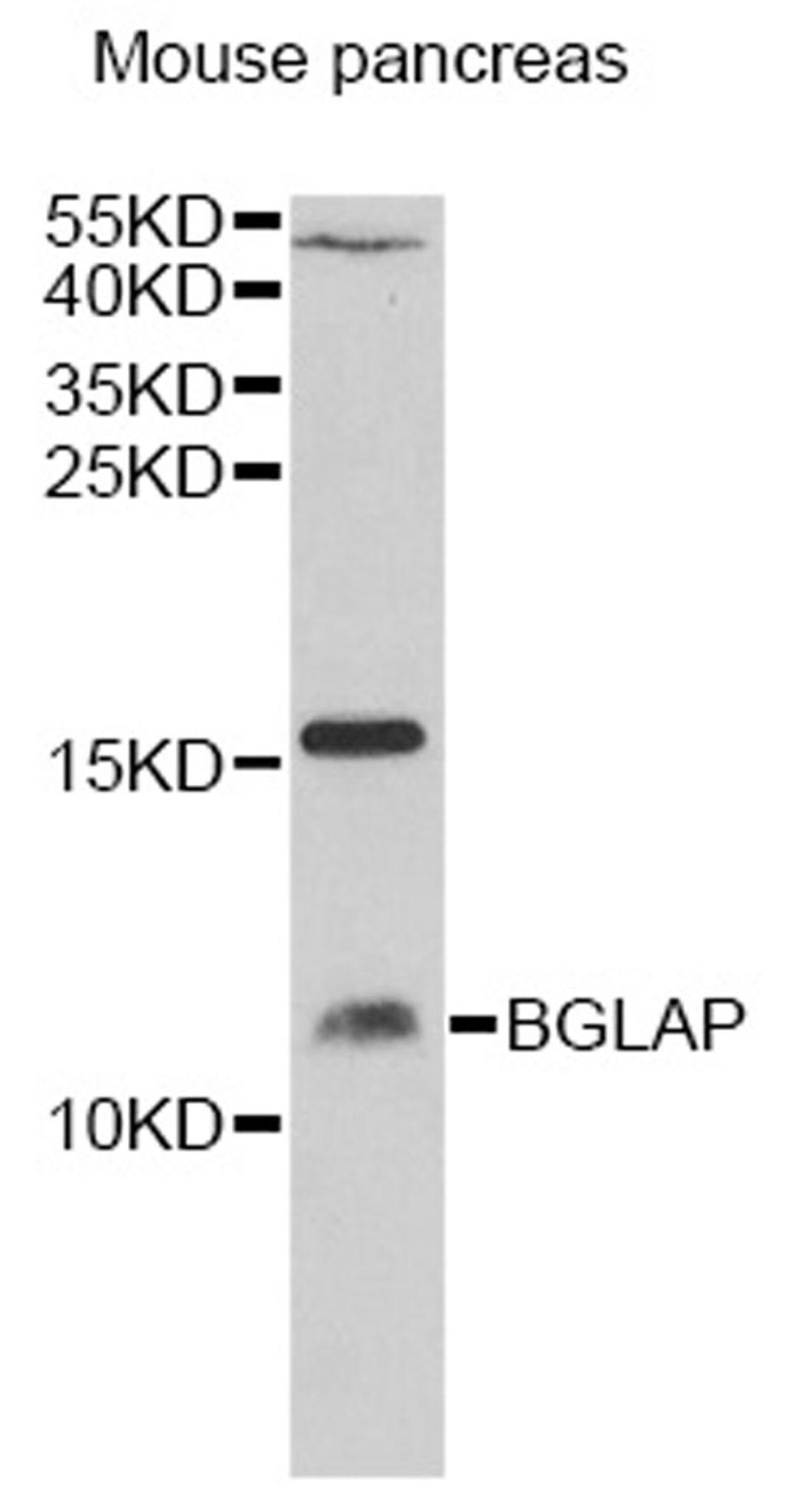 Western blot - BGLAP antibody (A14636)