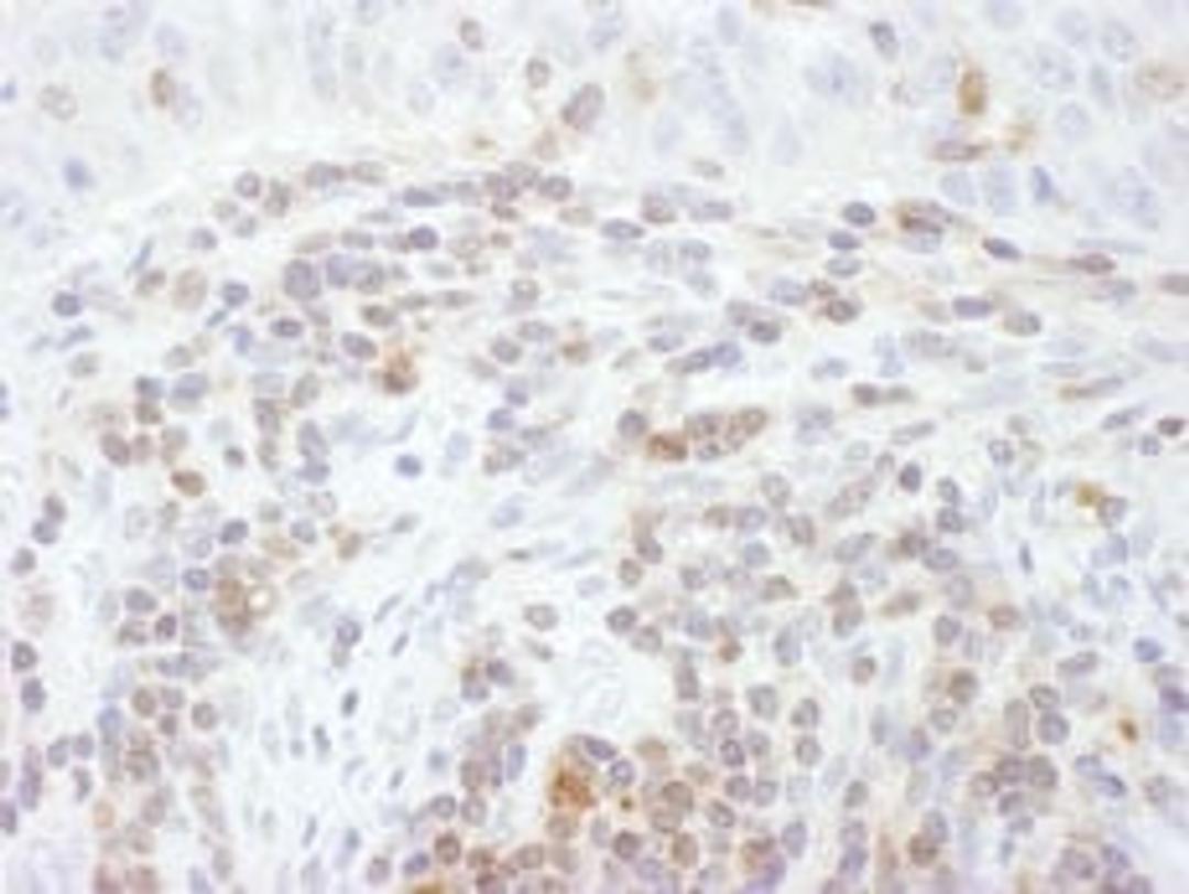 Detection of human STAT5a by immunohistochemistry.