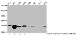 Western Blot. Detected samples: Hela whole cell lysate, 293 whole cell lysate, A549 whole cell lysate, K562 whole cell lysate; Untreated (-) or treated (+) with 50mM sodium 3-hydroxybutyrate for 72h. All lanes: HIST1H3A antibody at 1:100. Secondary. Goat polyclonal to rabbit IgG at 1/50000 dilution. Predicted band size: 16 kDa. Observed band size: 16 kDa