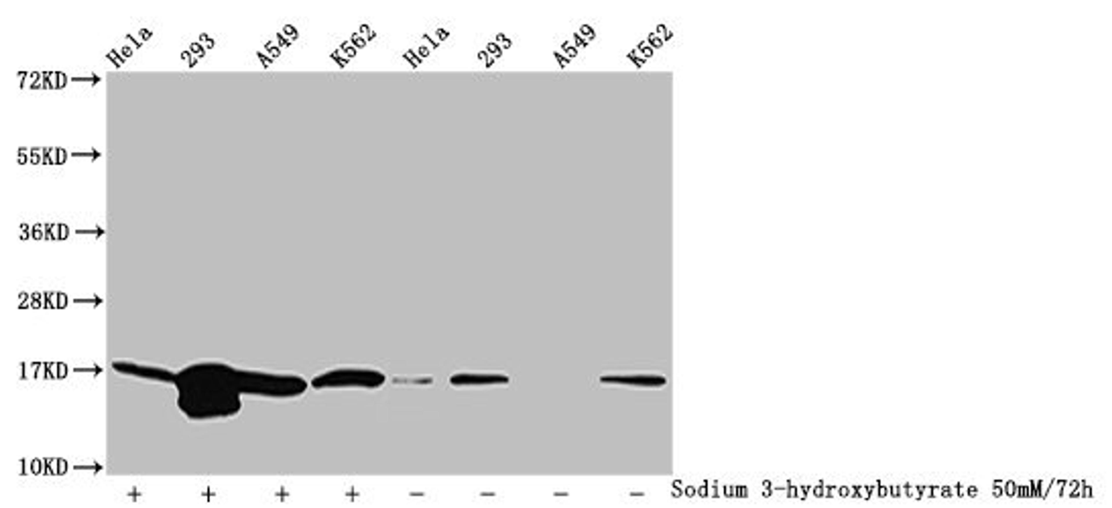 Western Blot. Detected samples: Hela whole cell lysate, 293 whole cell lysate, A549 whole cell lysate, K562 whole cell lysate; Untreated (-) or treated (+) with 50mM sodium 3-hydroxybutyrate for 72h. All lanes: HIST1H3A antibody at 1:100. Secondary. Goat polyclonal to rabbit IgG at 1/50000 dilution. Predicted band size: 16 kDa. Observed band size: 16 kDa
