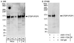 Detection of human and mouse CTDP1/FCP1 by western blot (h&m) and immunoprecipitation (h).