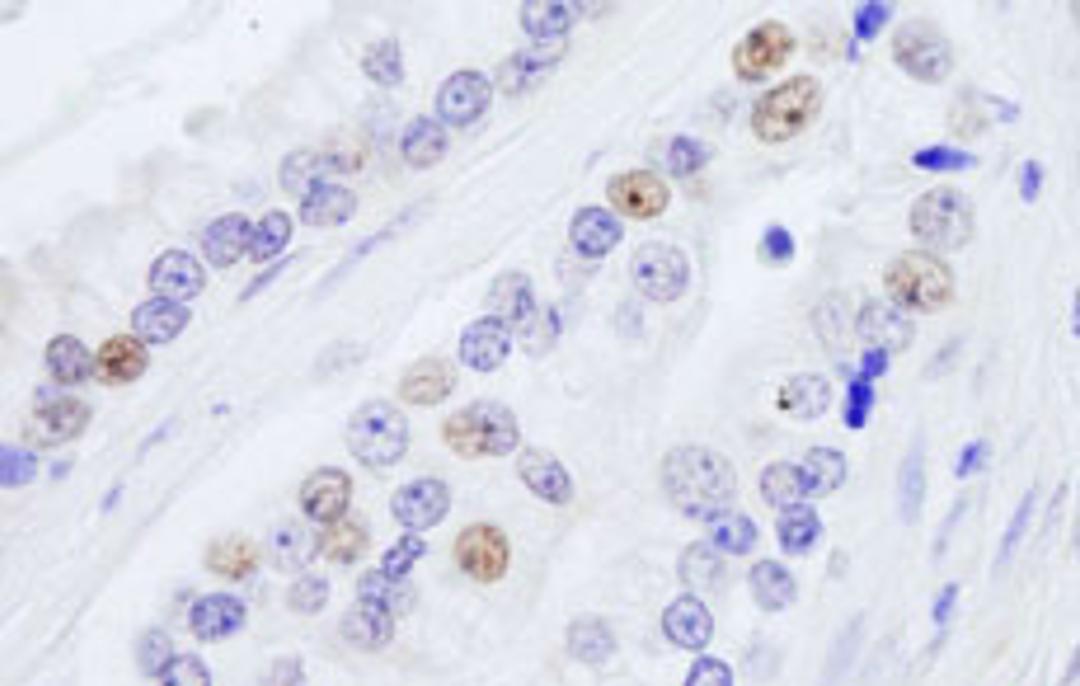 Detection of human NONO by immunohistochemistry.