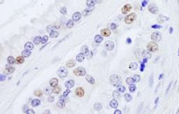 Detection of human NONO by immunohistochemistry.