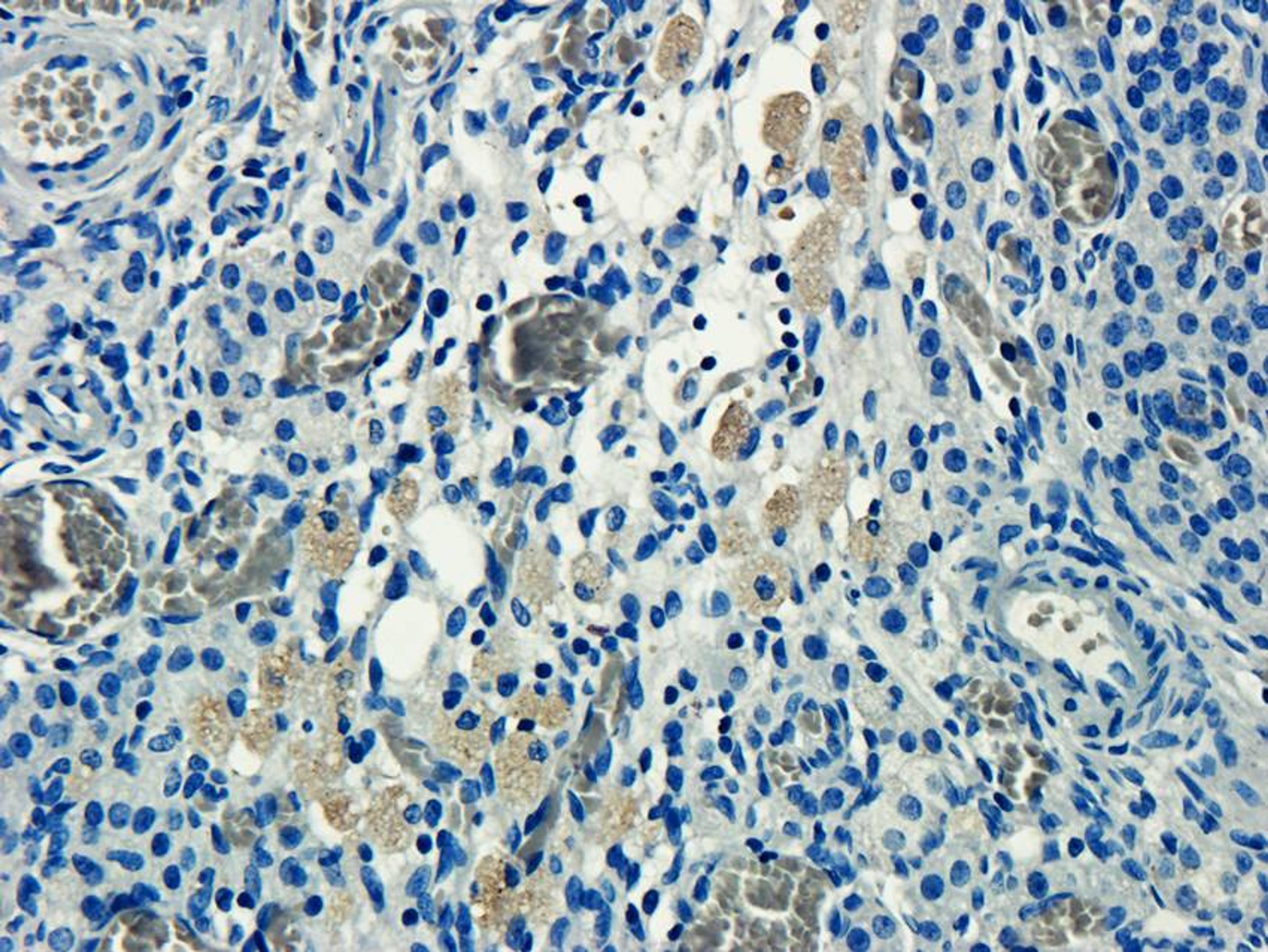 Immunohistochemical staining of paraffin embedded rat ovary tissue using anti-CD155 (primary antibody at 2.5 ug/ml)