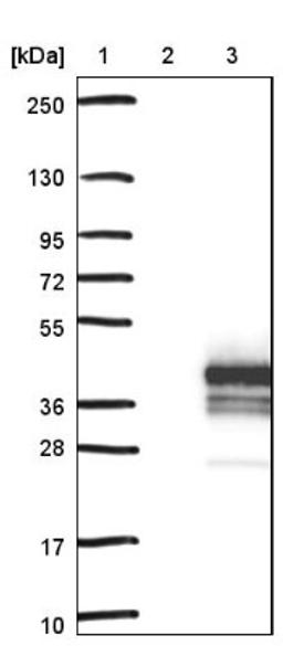 Western Blot: DBNDD2 Antibody [NBP1-91819] - Lane 1: Marker [kDa] 250, 130, 95, 72, 55, 36, 28, 17, 10<br/>Lane 2: Negative control (vector only transfected HEK293T lysate)<br/>Lane 3: Over-expression lysate (Co-expressed with a C-terminal myc-DDK tag (~3.1 kDa) in mammalian HEK293T cells, LY420786)