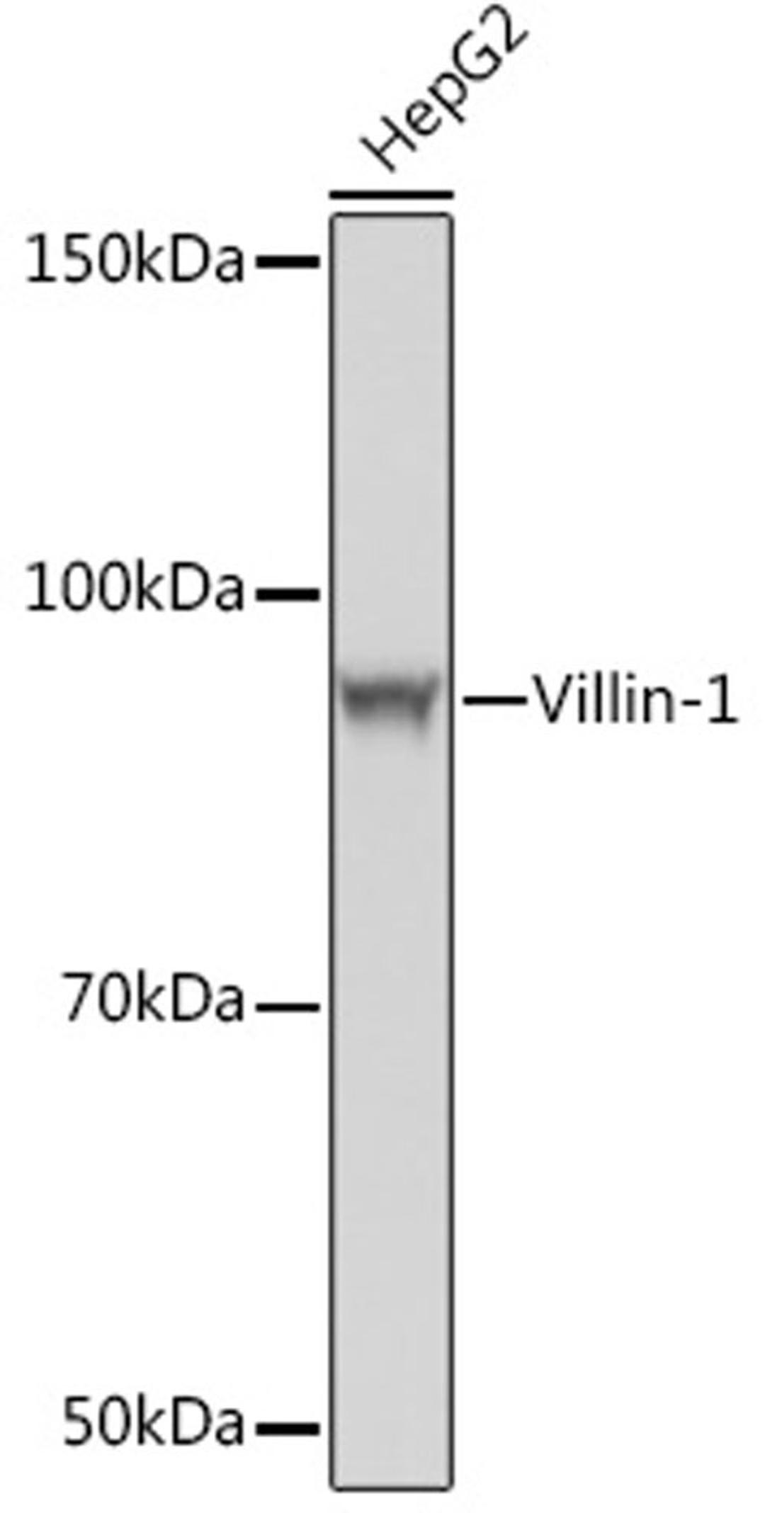 Western blot - Villin-1  Rabbit mAb (A4691)