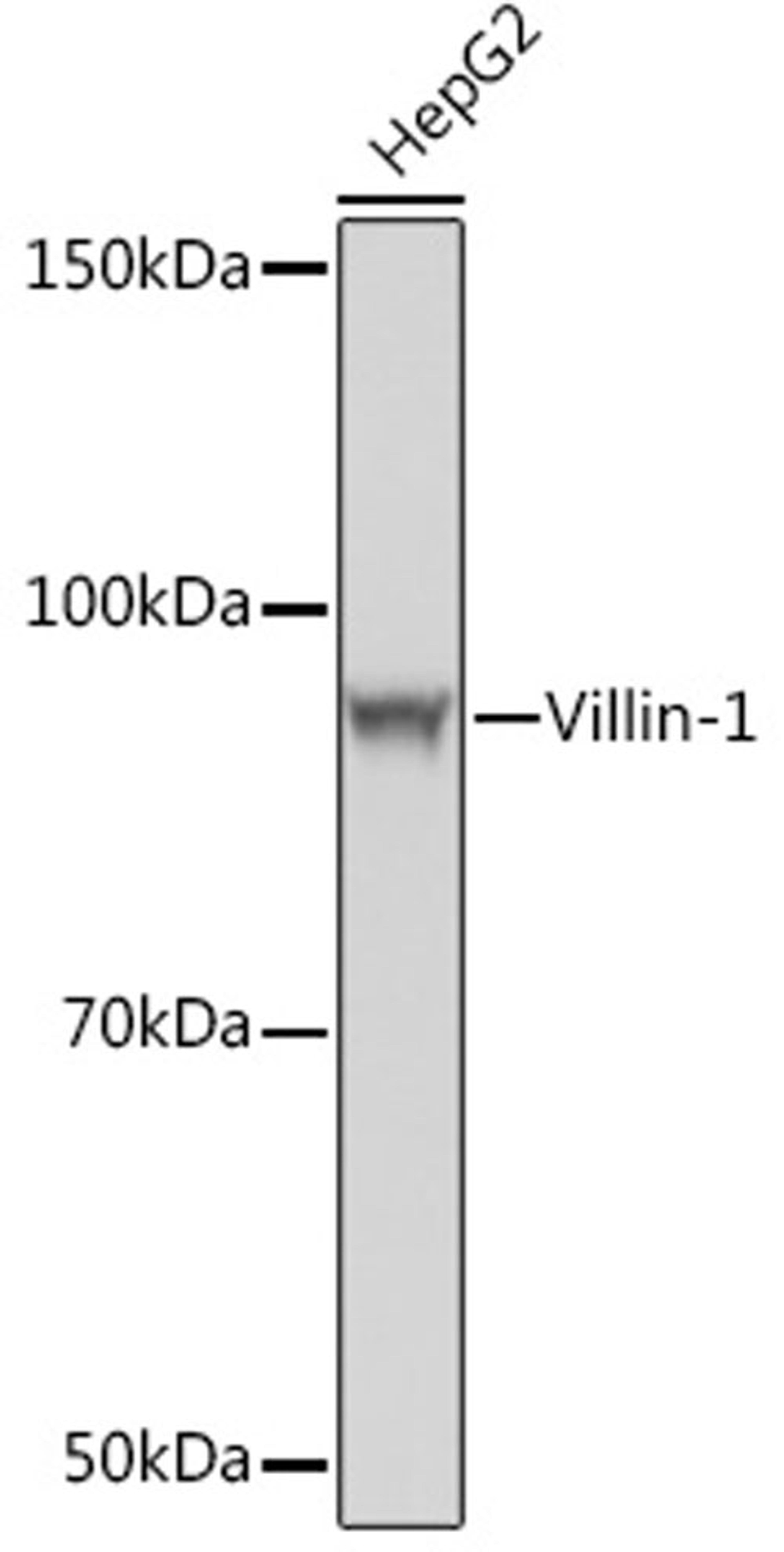 Western blot - Villin-1  Rabbit mAb (A4691)