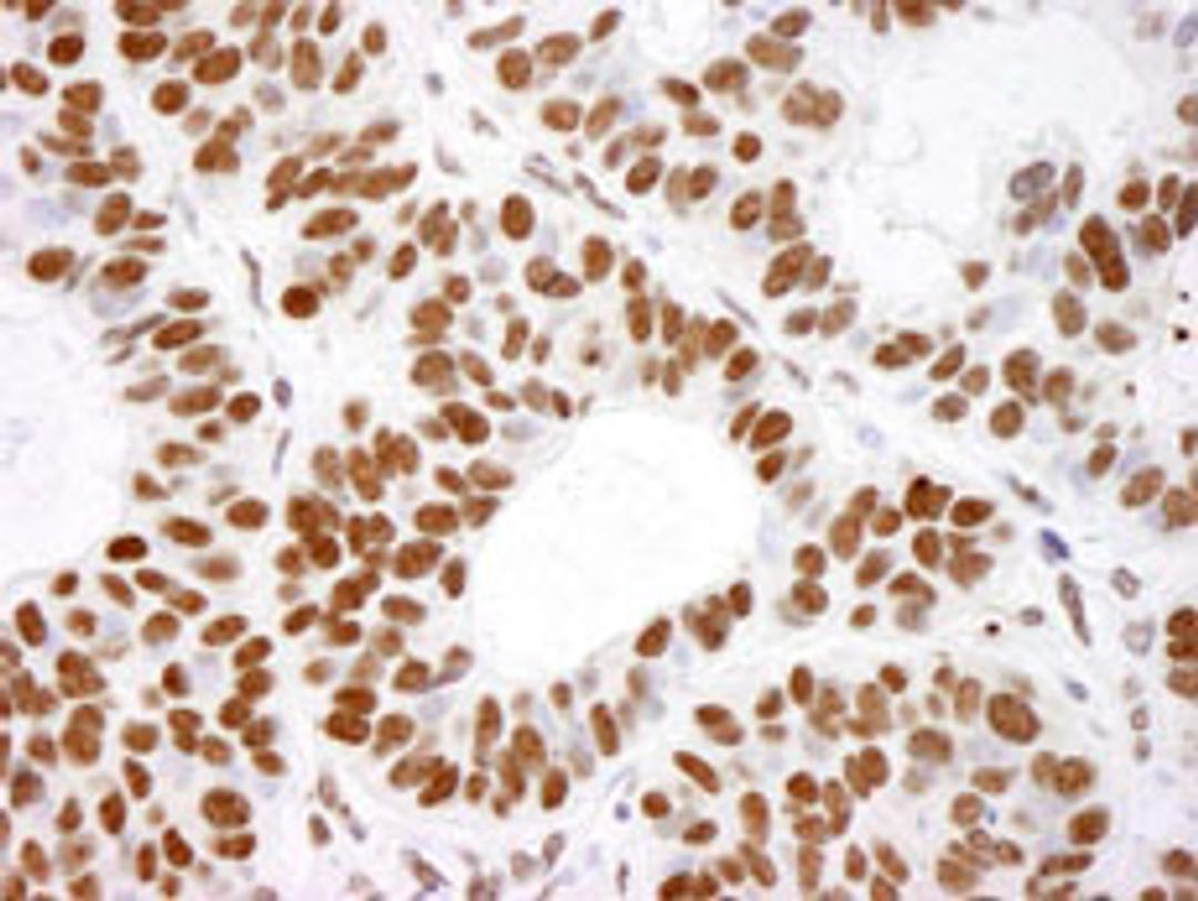 Detection of human Histone H4 by immunohistochemistry.