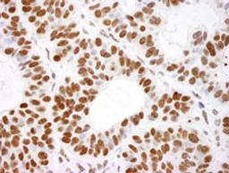 Detection of human Histone H4 by immunohistochemistry.