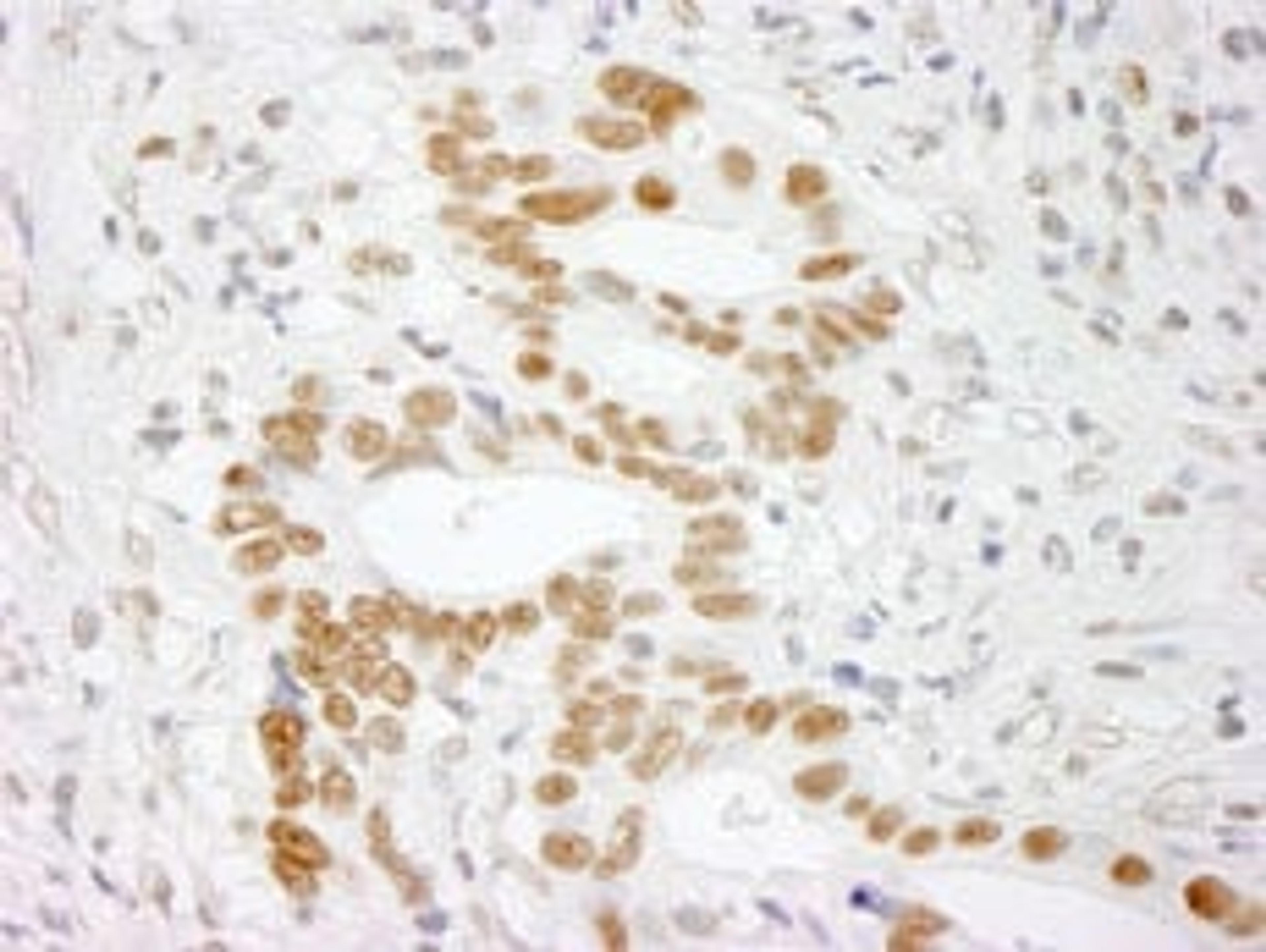 Detection of human RALY immunohistochemistry.