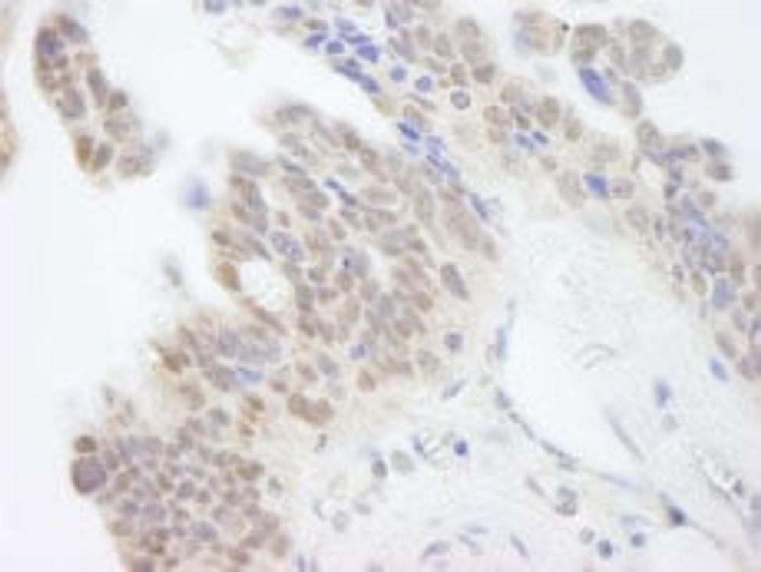 Detection of human ABI1 by immunohistochemistry.