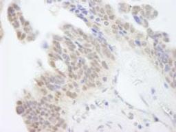 Detection of human ABI1 by immunohistochemistry.