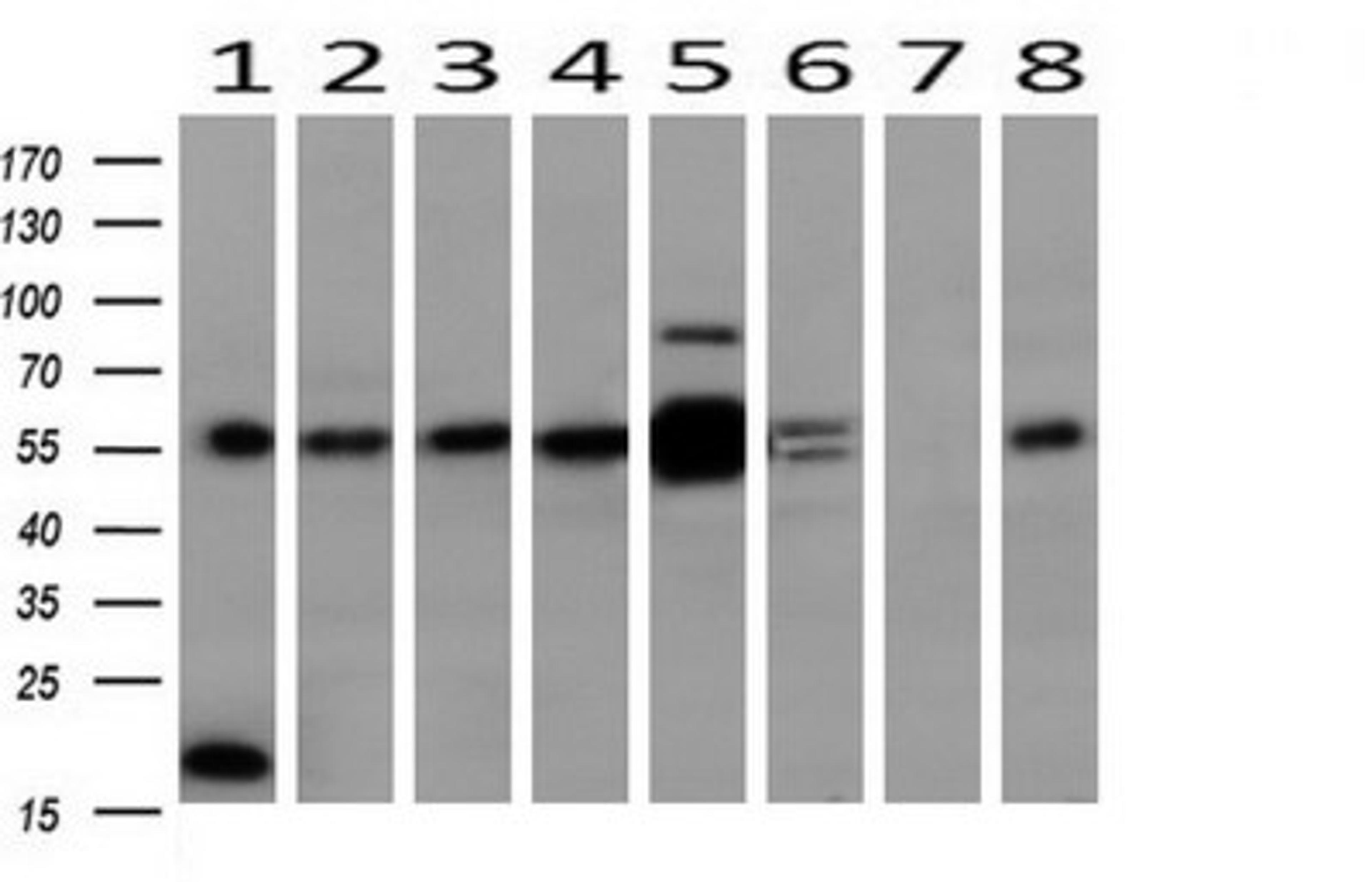 Western Blot: ERK4/MAPK4 Antibody (2D7) [NBP2-45743] - Analysis of extracts (10ug) from 8 Human tissue (1: Testis; 2: Uterus; 3: Breast; 4: Brain; 5: Liver; 6: Ovary; 7: Thyroid gland; 8: Colon).