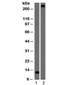 Western blot testing of 1) partial recombinant protein and 2) human lung lysate with vWF antibody (clone VWF/1465). Predicted molecular weight ~250 kDa.