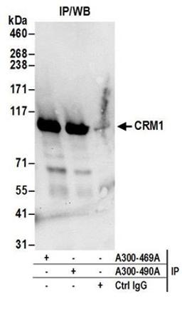 Detection of human CRM1 by western blot of immunoprecipitates.