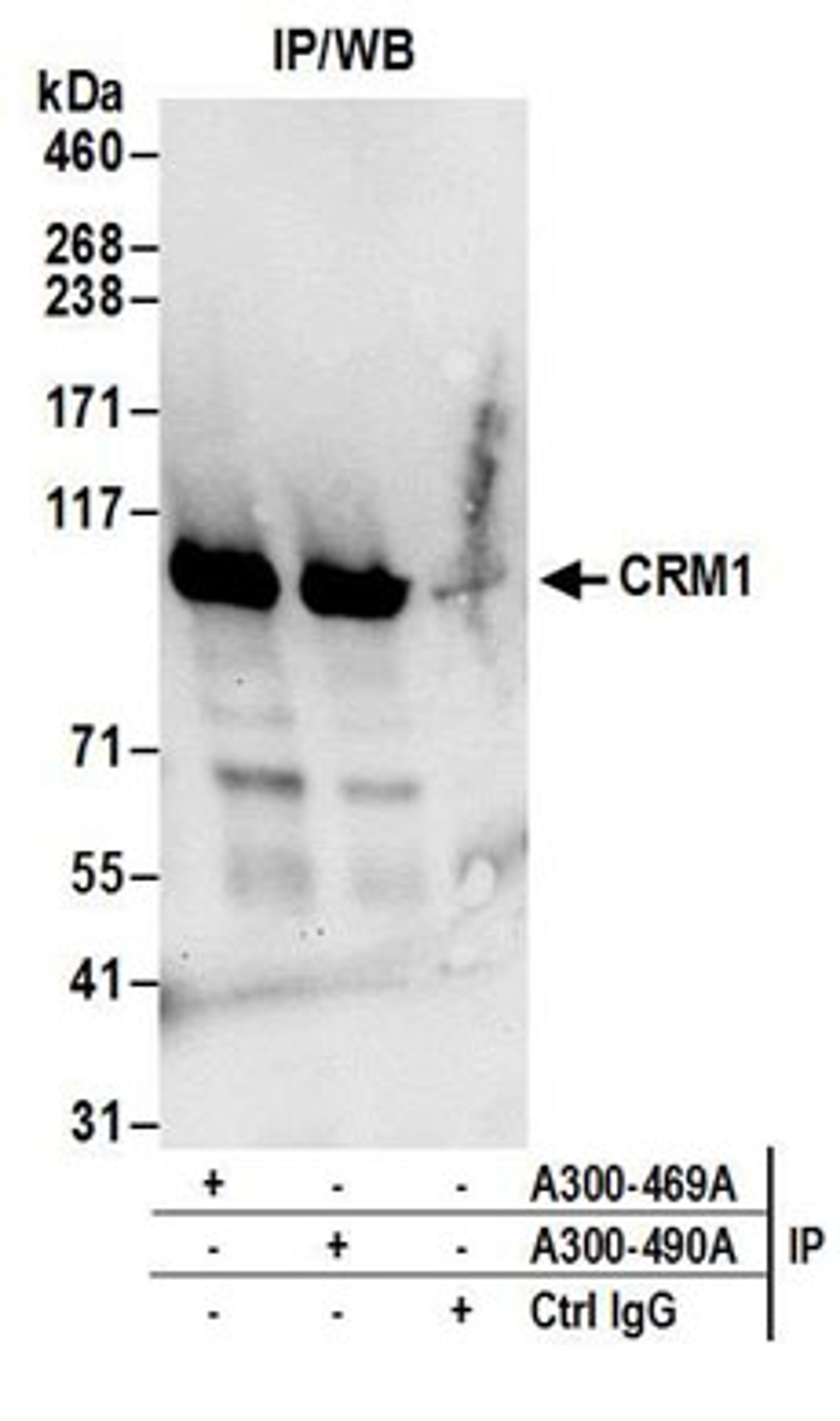 Detection of human CRM1 by western blot of immunoprecipitates.