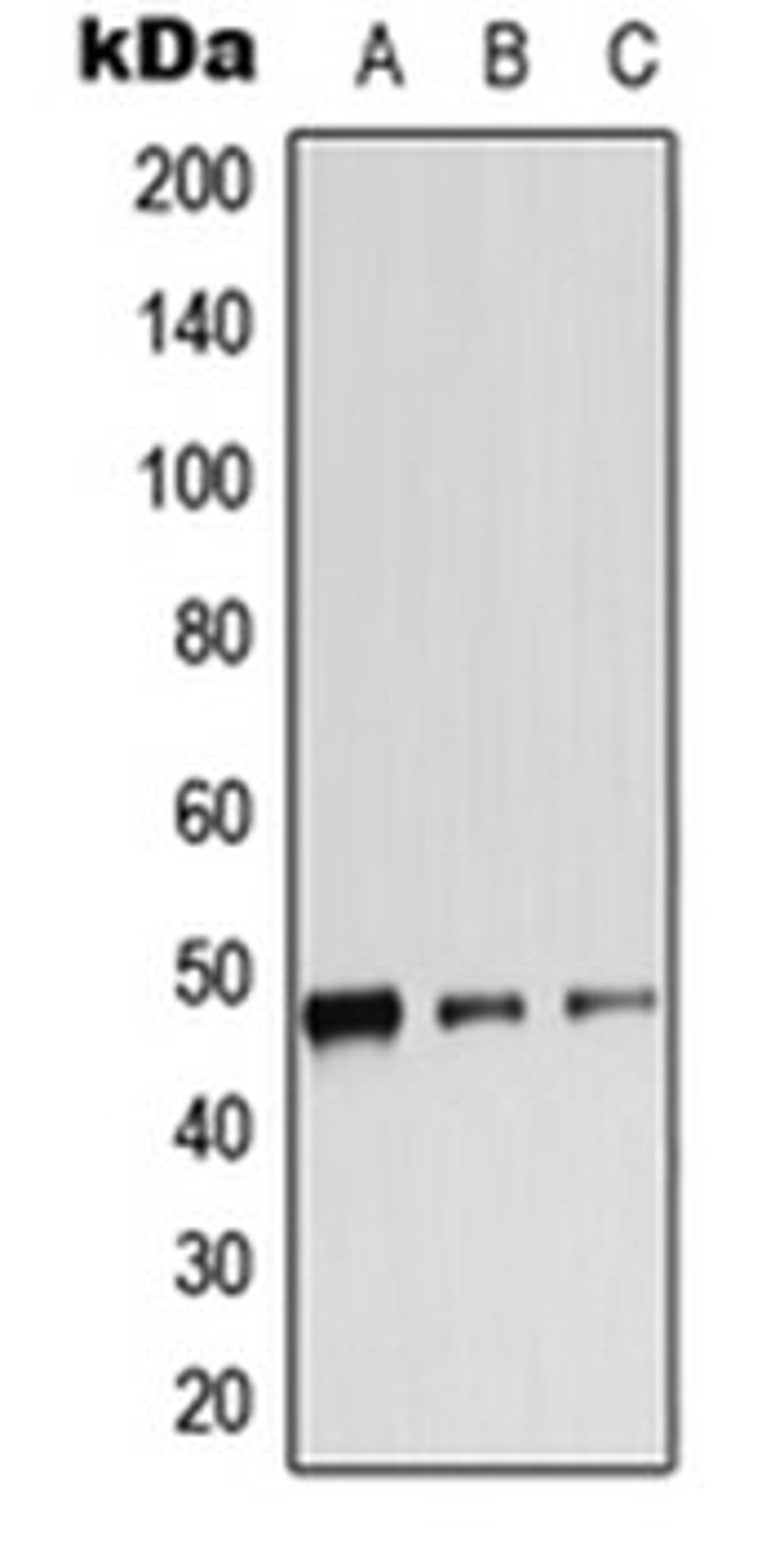 Western blot analysis of HepG2 PMA-treated (Lane 1), mouse spleen (Lane 2), rat spleen (Lane 3) whole cell lysates using ADRB2 antibody