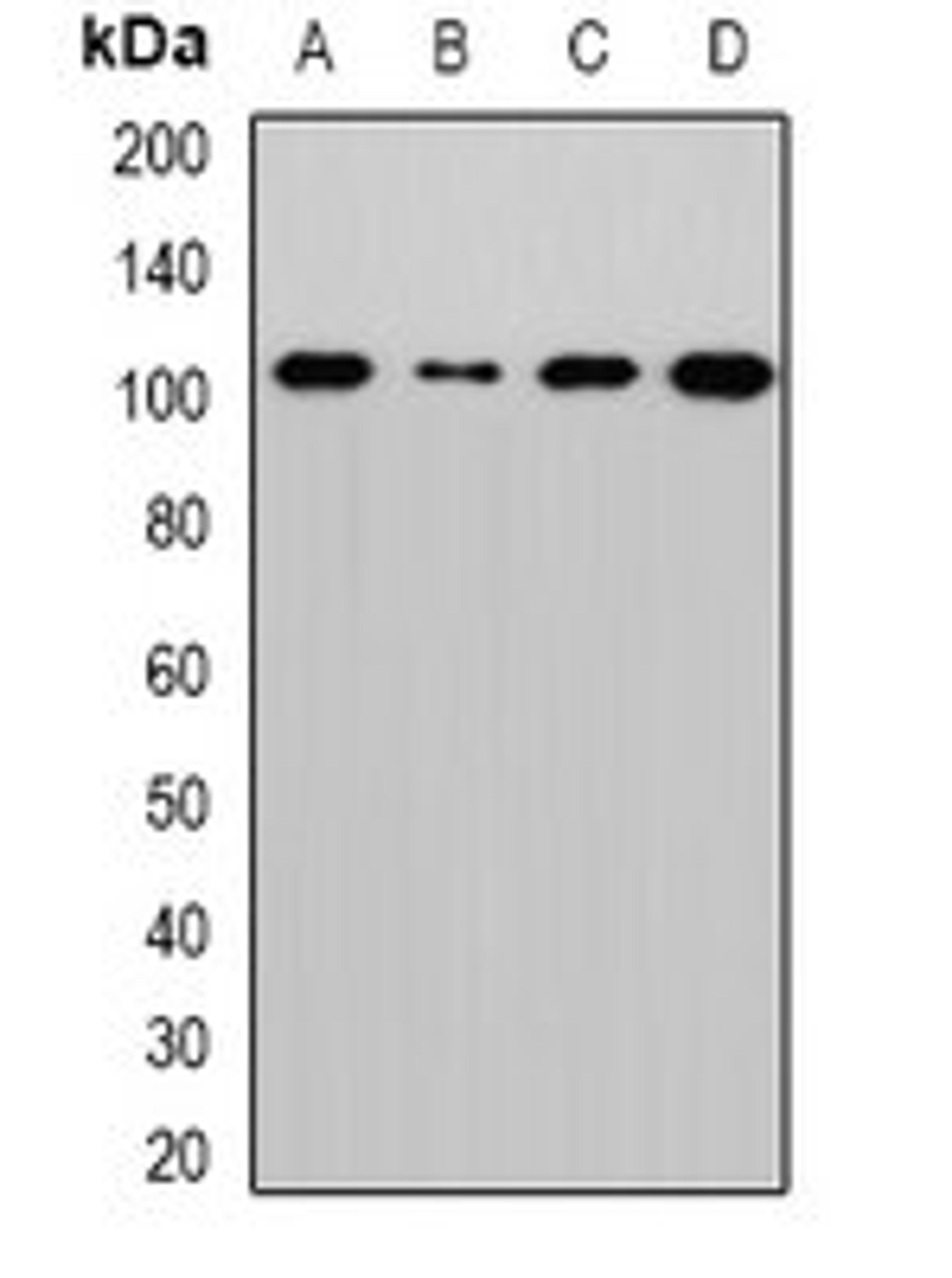 Western blot analysis of MCF7 (Lane1), Hela (Lane2), mouse lung (Lane3), rat brain (Lane4) whole cell lysates using EXOC2 antibody