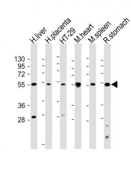 Western Blot at 1:2000 dilution Lane 1: human liver lysate Lane 2: human placenta lysate Lane 3: HT-29 whole cell lysate Lane 4: mouse heart lysate Lane 5: mouse spleen lysate Lane 5: rat stomach lysate Lysates/proteins at 20 ug per lane.