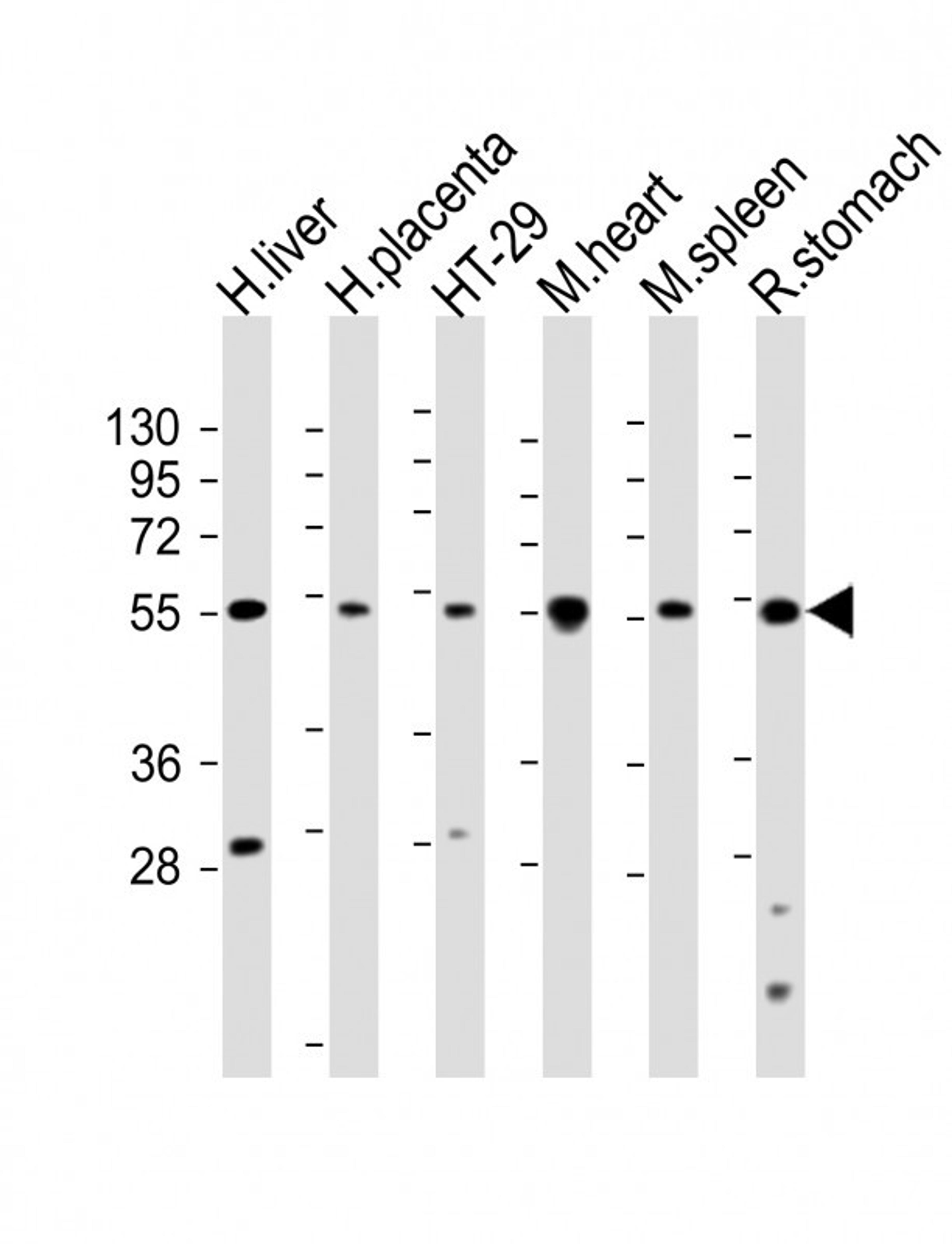 Western Blot at 1:2000 dilution Lane 1: human liver lysate Lane 2: human placenta lysate Lane 3: HT-29 whole cell lysate Lane 4: mouse heart lysate Lane 5: mouse spleen lysate Lane 5: rat stomach lysate Lysates/proteins at 20 ug per lane.