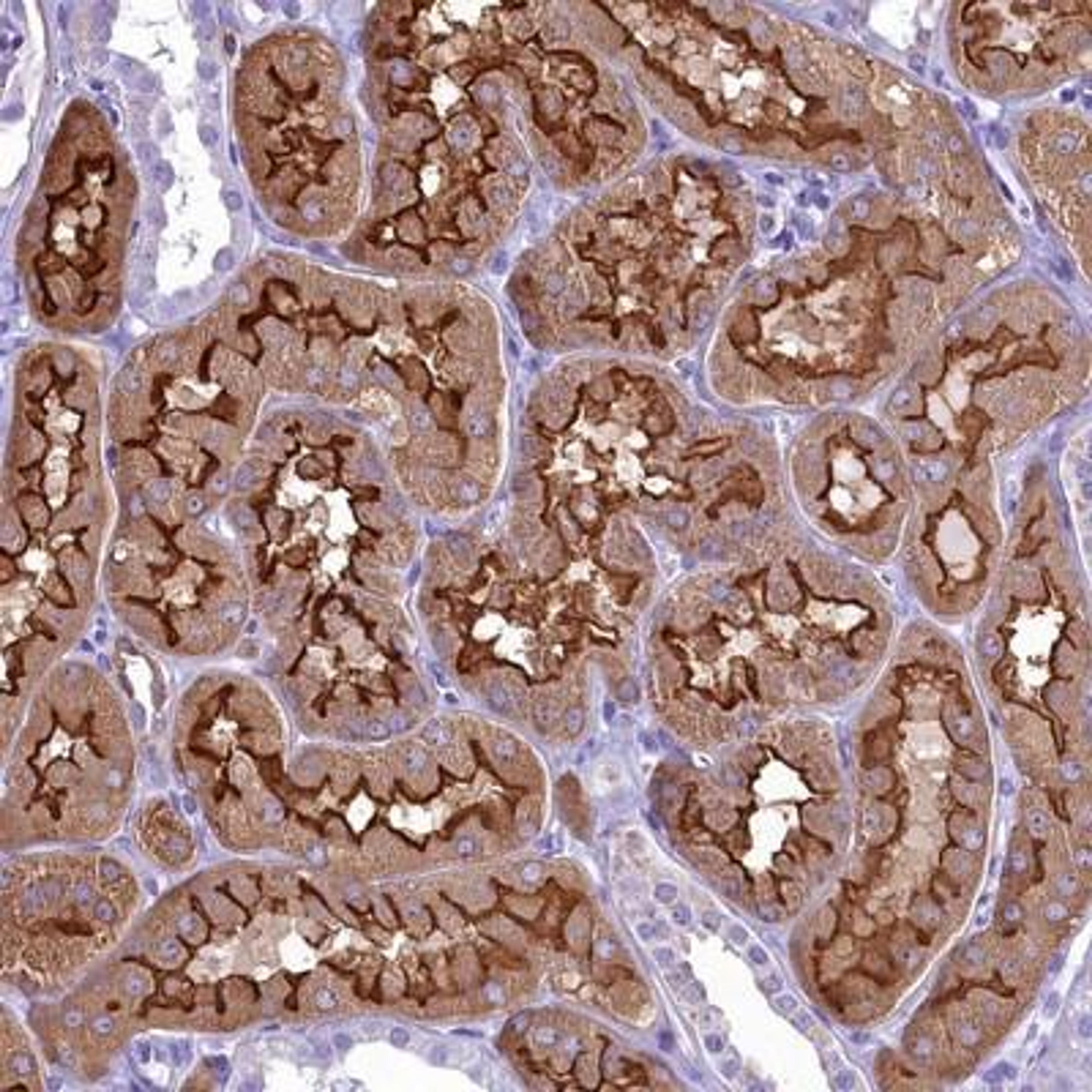 Immunohistochemistry: SGLT2/SLC5A2 Antibody [NBP1-92384] - Staining of human kidney shows strong membranous and cytoplasmic positivity in tubular cells.