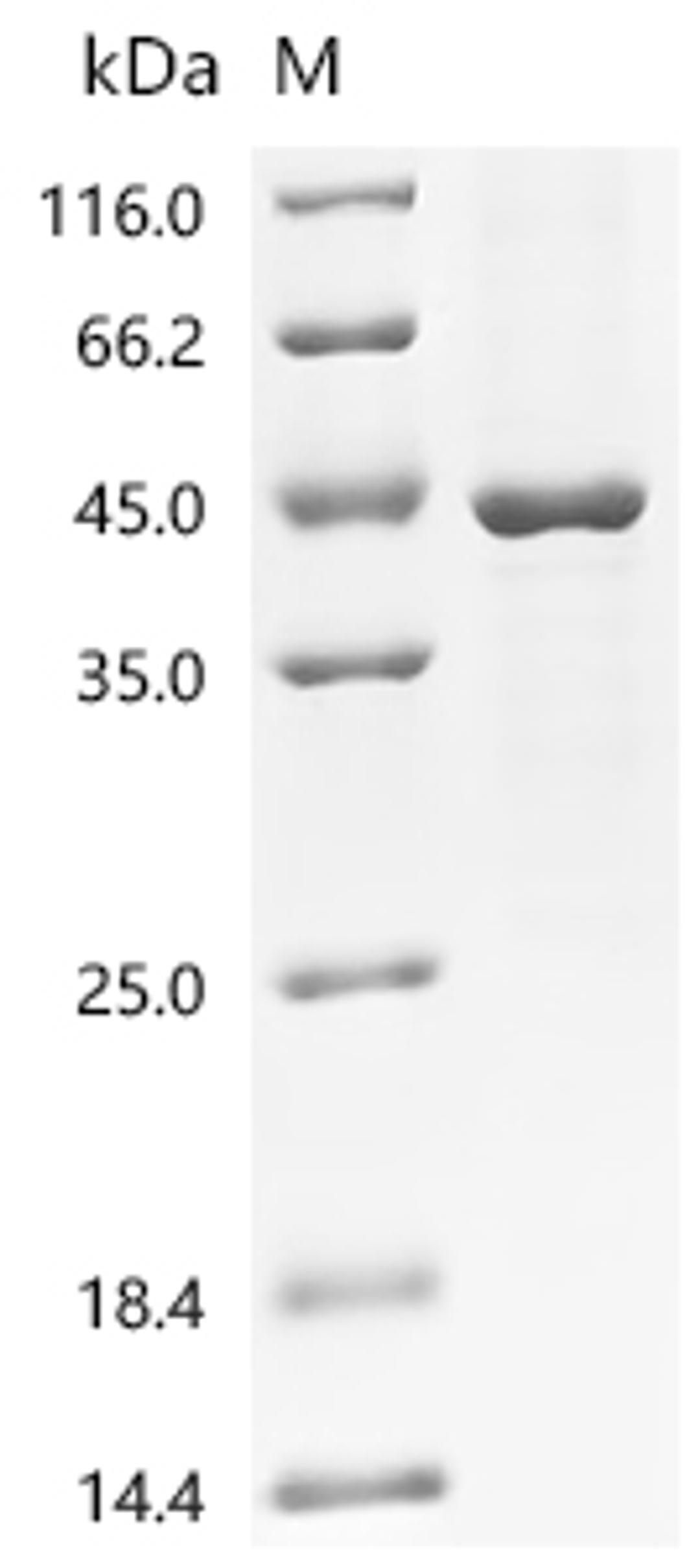 (Tris-Glycine gel) Discontinuous SDS-PAGE (reduced) with 5% enrichment gel and 15% separation gel.