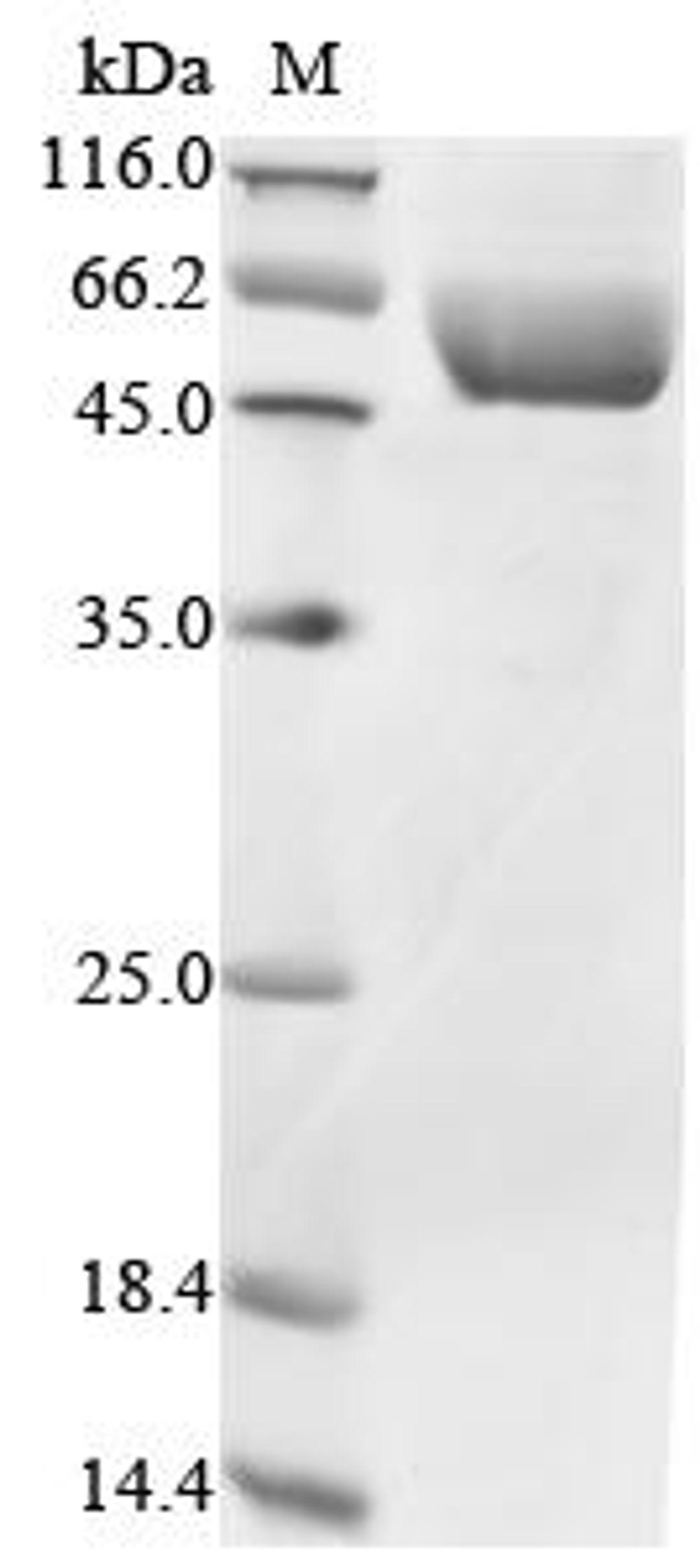 (Tris-Glycine gel) Discontinuous SDS-PAGE (reduced) with 5% enrichment gel and 15% separation gel.