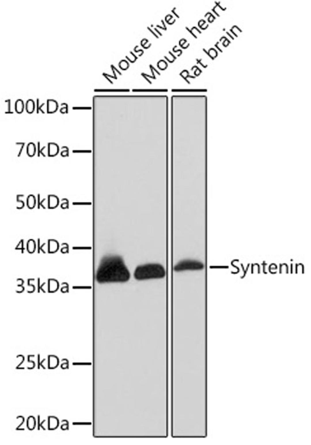 Western blot - Syntenin Rabbit mAb (A5497)