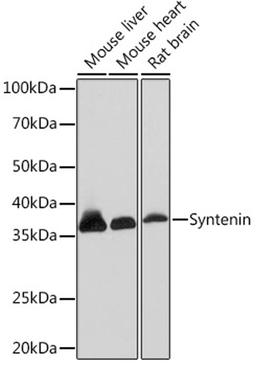 Western blot - Syntenin Rabbit mAb (A5497)