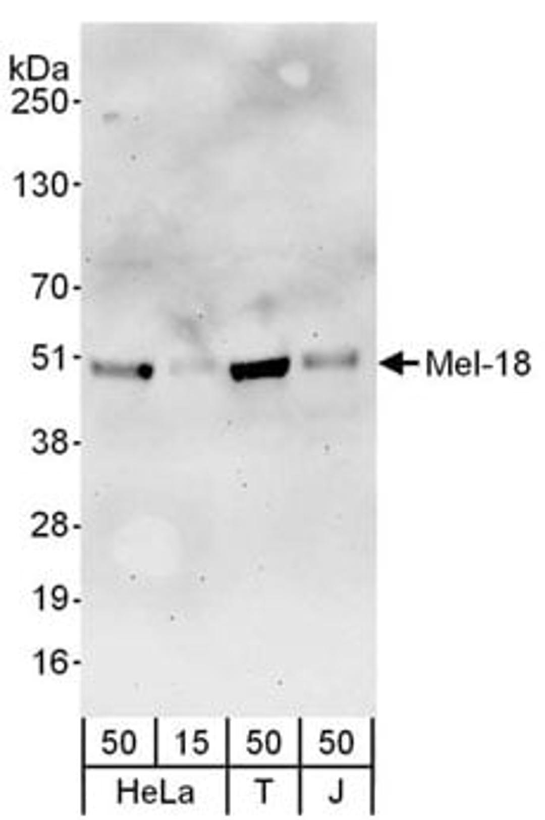 Detection of human Mel-18 by western blot.