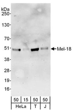 Detection of human Mel-18 by western blot.