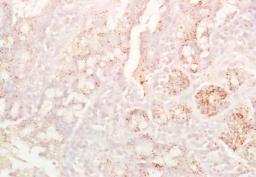 Immunohistochemical analysis of formalin-fixed paraffin embedded  rat colon tissue using CD8B antibody (Dilution at :1:200)