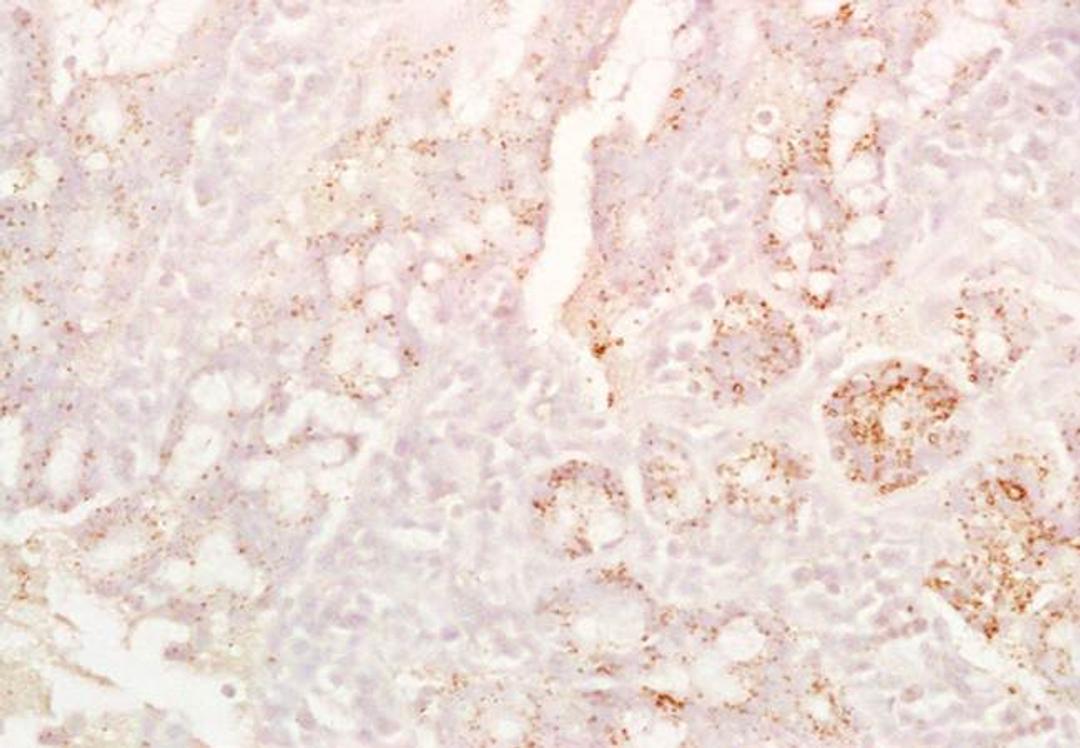 Immunohistochemical analysis of formalin-fixed paraffin embedded rat colon tissue using CD8B antibody (Dilution at :1:200)
