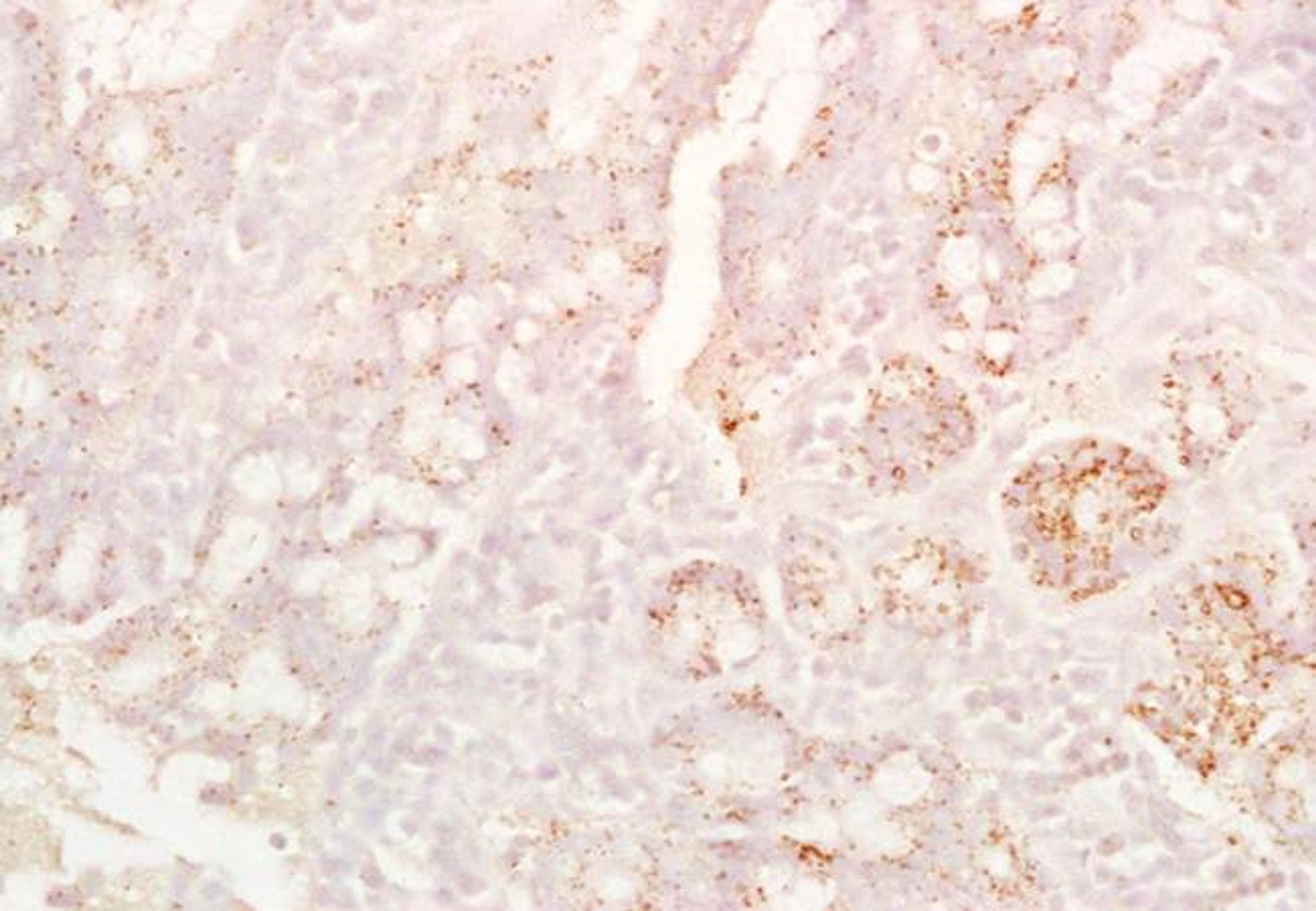 Immunohistochemical analysis of formalin-fixed paraffin embedded rat colon tissue using CD8B antibody (Dilution at :1:200)