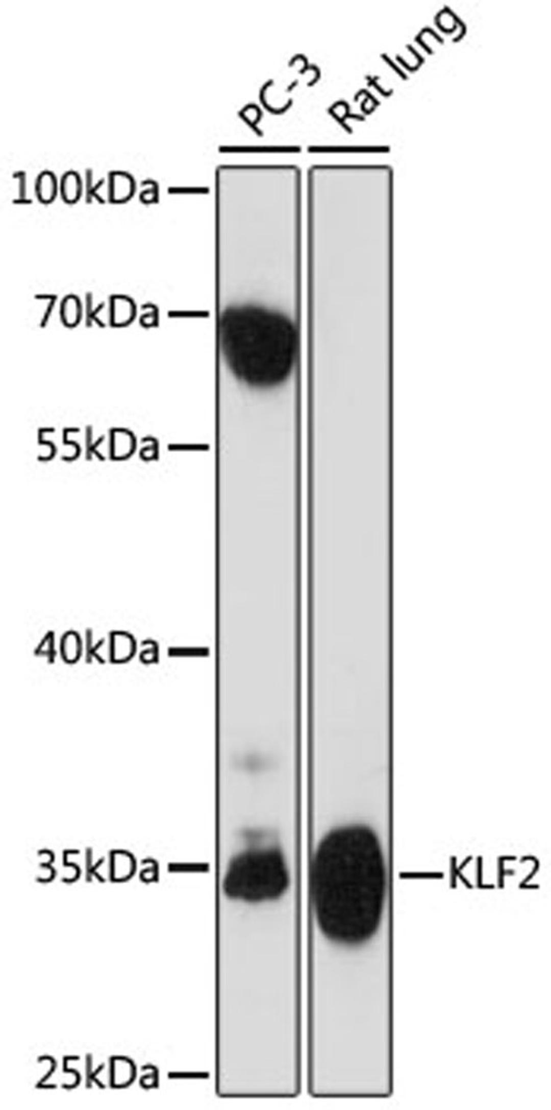 Western blot - KLF2 antibody (A16480)