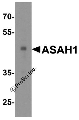 Western blot analysis of ASAH1 in human heart tissue lysate with ASAH1 antibody at 1 μg/mL.