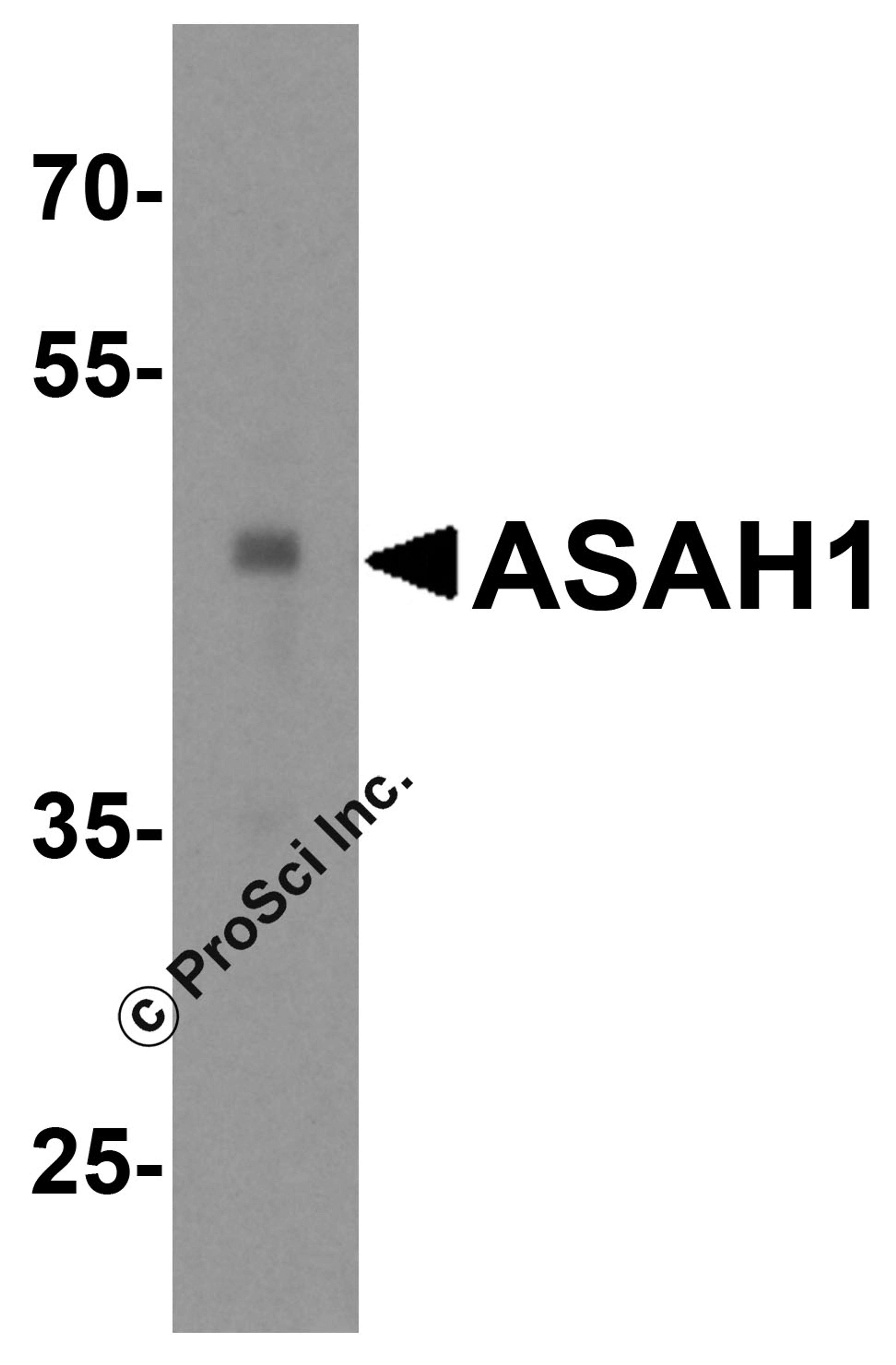 Western blot analysis of ASAH1 in human heart tissue lysate with ASAH1 antibody at 1 μg/mL.