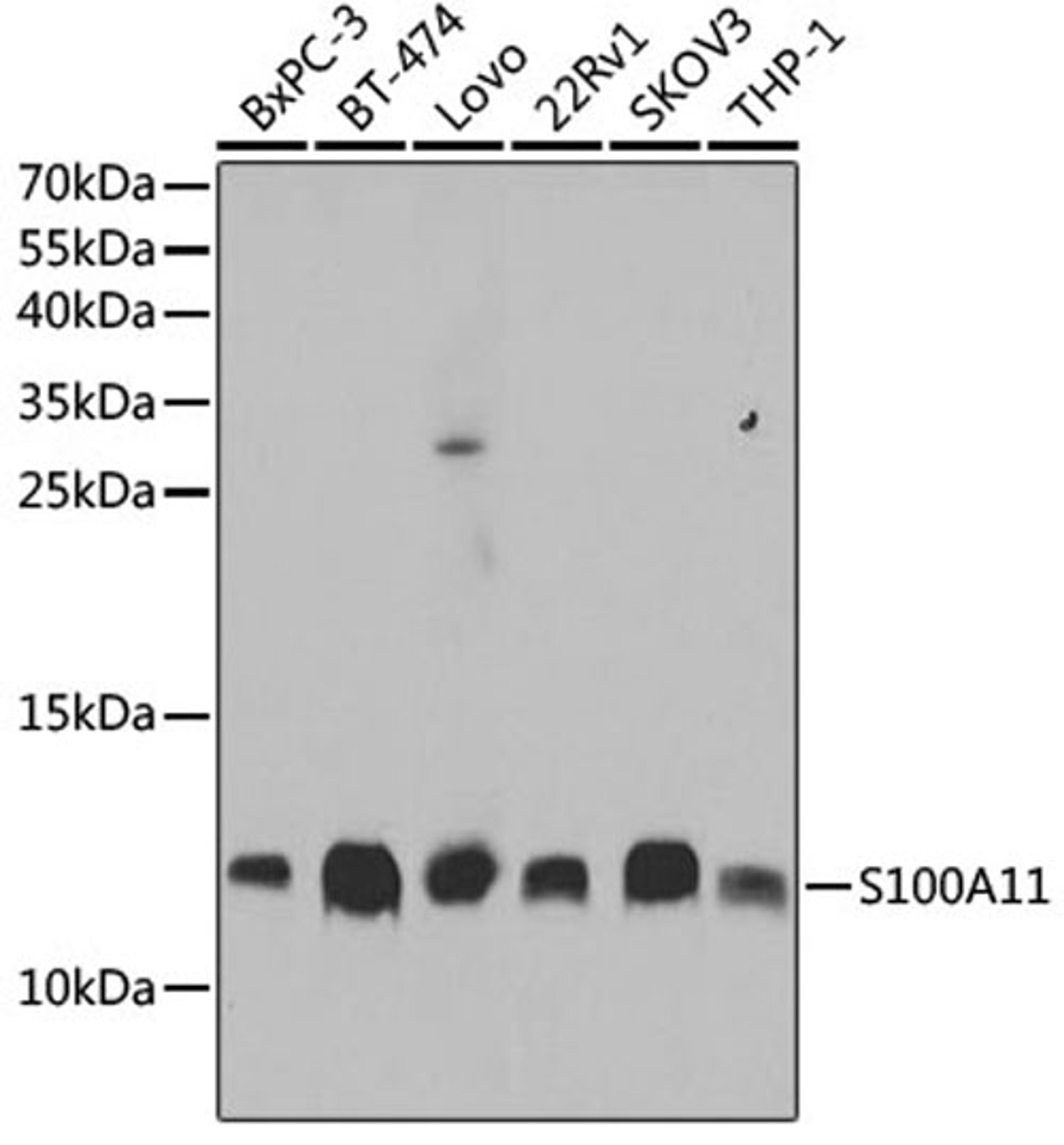 Western blot - S100A11 antibody (A5486)