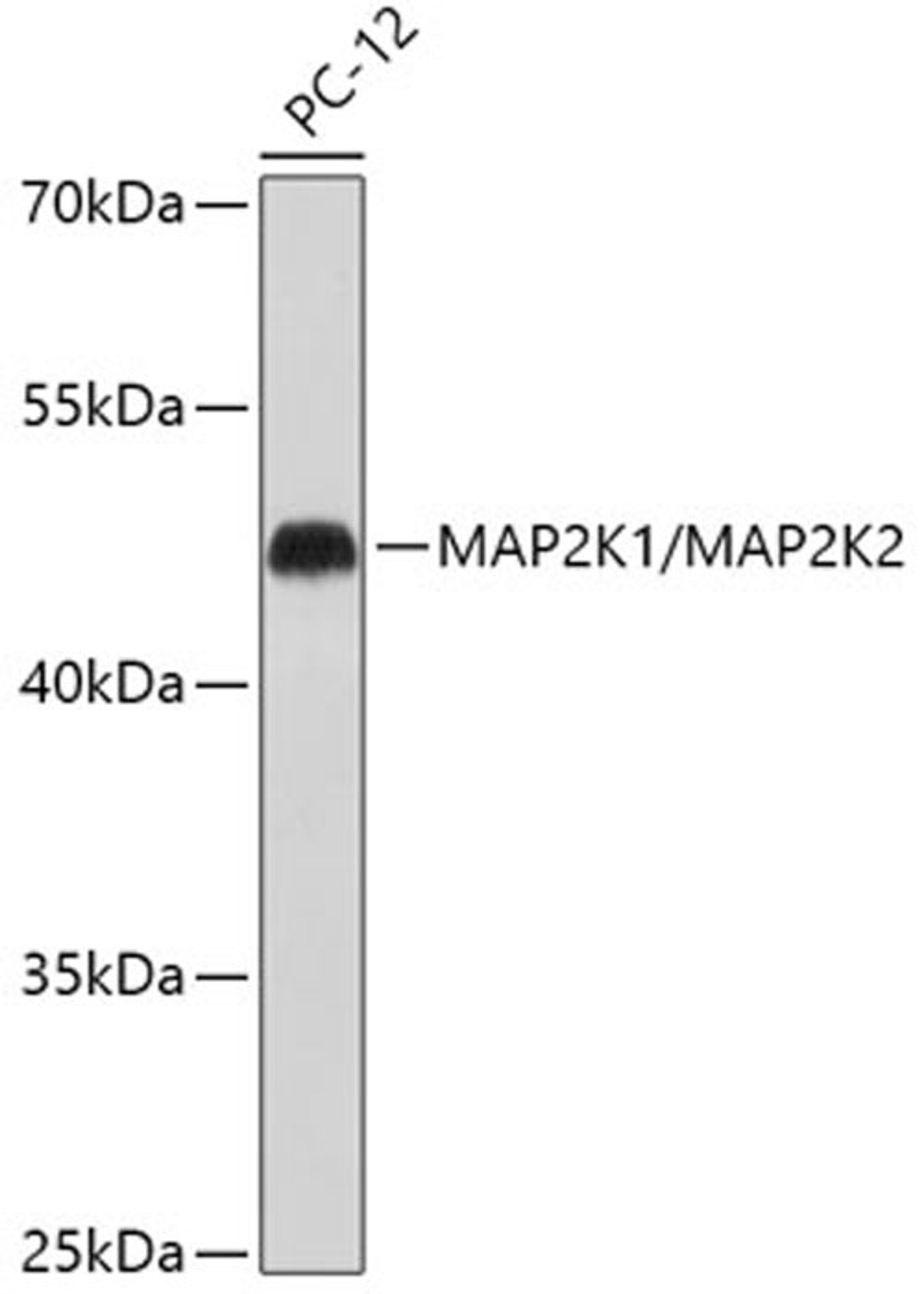 Western blot - MAP2K1/MAP2K2 antibody (A18117)