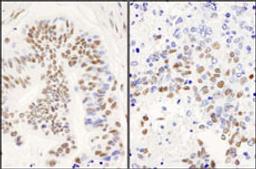 Detection of human and mouse DBC1/p30 DBC by immunohistochemistry.