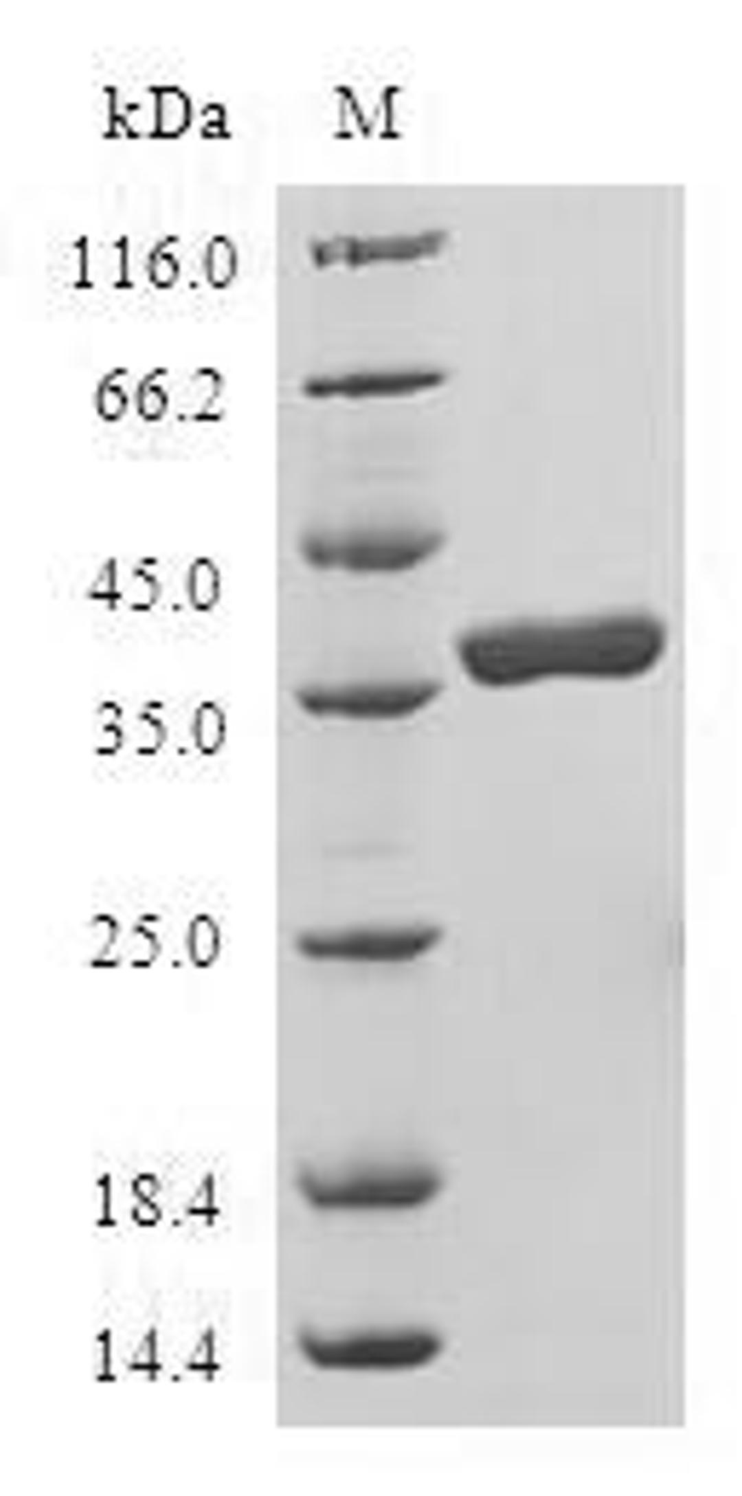 (Tris-Glycine gel) Discontinuous SDS-PAGE (reduced) with 5% enrichment gel and 15% separation gel.