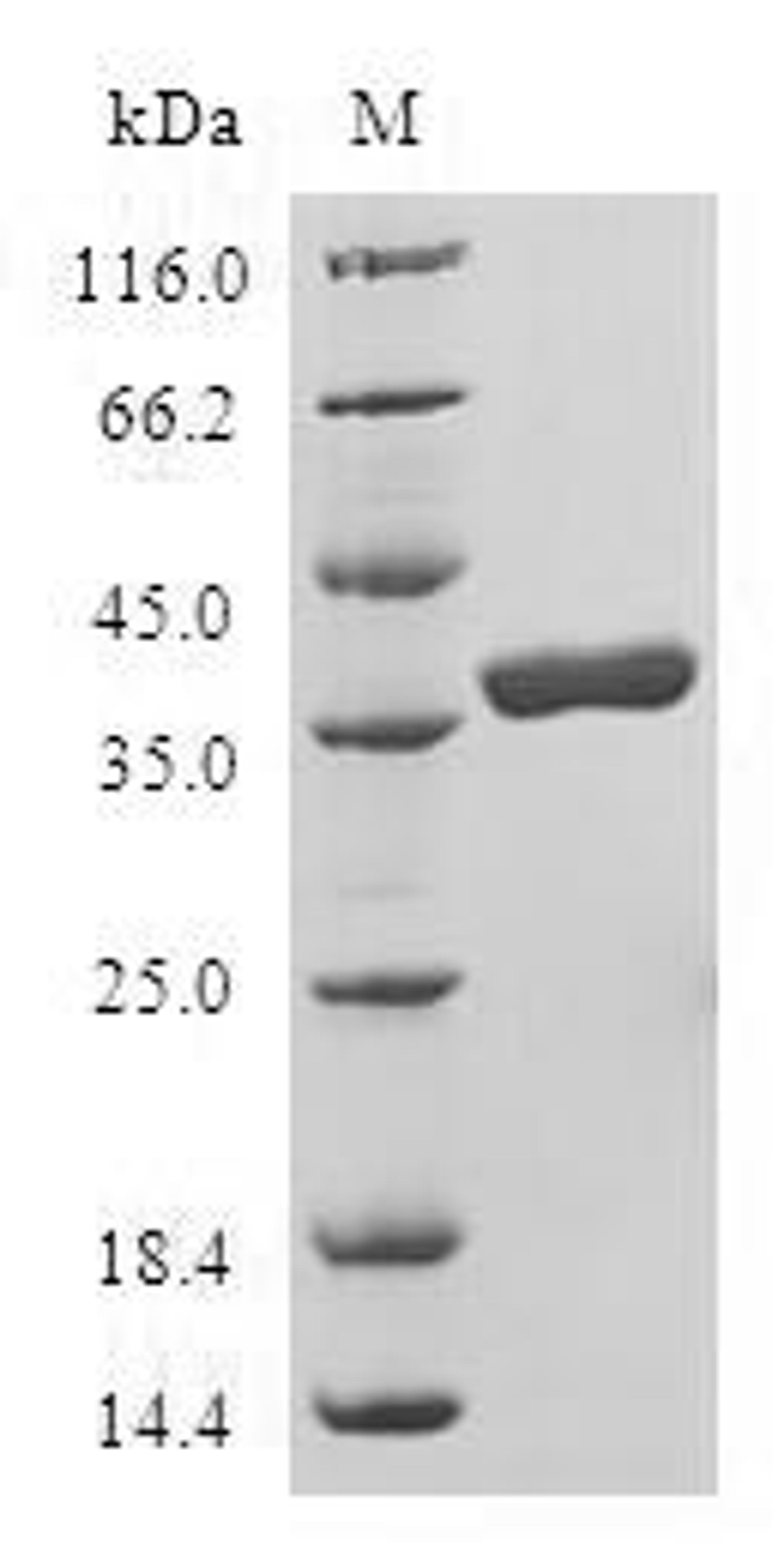 (Tris-Glycine gel) Discontinuous SDS-PAGE (reduced) with 5% enrichment gel and 15% separation gel.