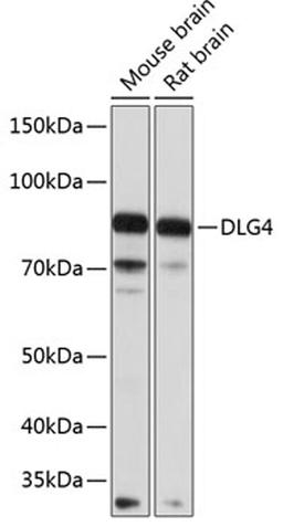 Western blot - DLG4 Polyclonal Antibody (A6194)