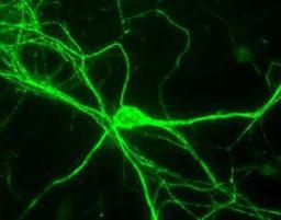 Immunocytochemistry/Immunofluorescence: 200kDa Neurofilament Heavy Antibody [NB300-217] - Rat neurons stained with 200kDa Neurofilament Heavy Antibody NB300-217.