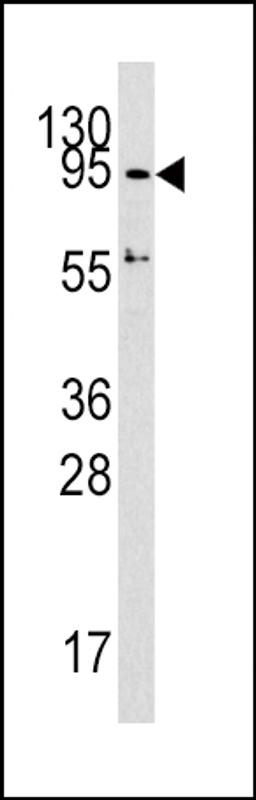 Western blot analysis of DNMT3A Antibody in HepG2 cell line lysates (35ug/lane)