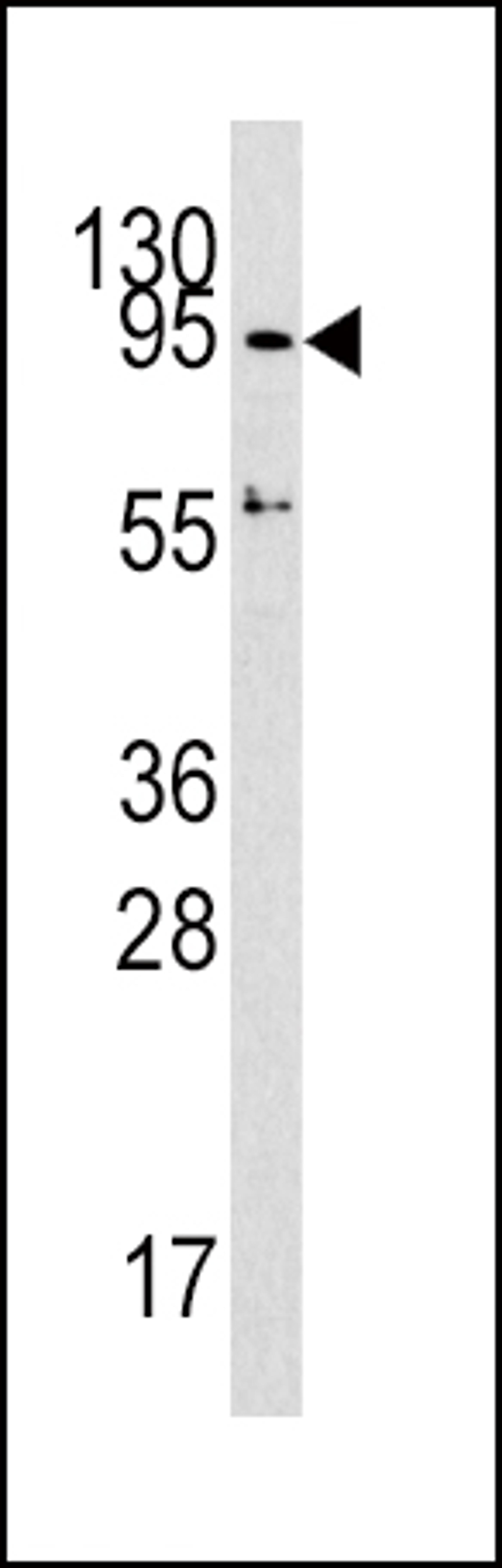 Western blot analysis of DNMT3A Antibody in HepG2 cell line lysates (35ug/lane)