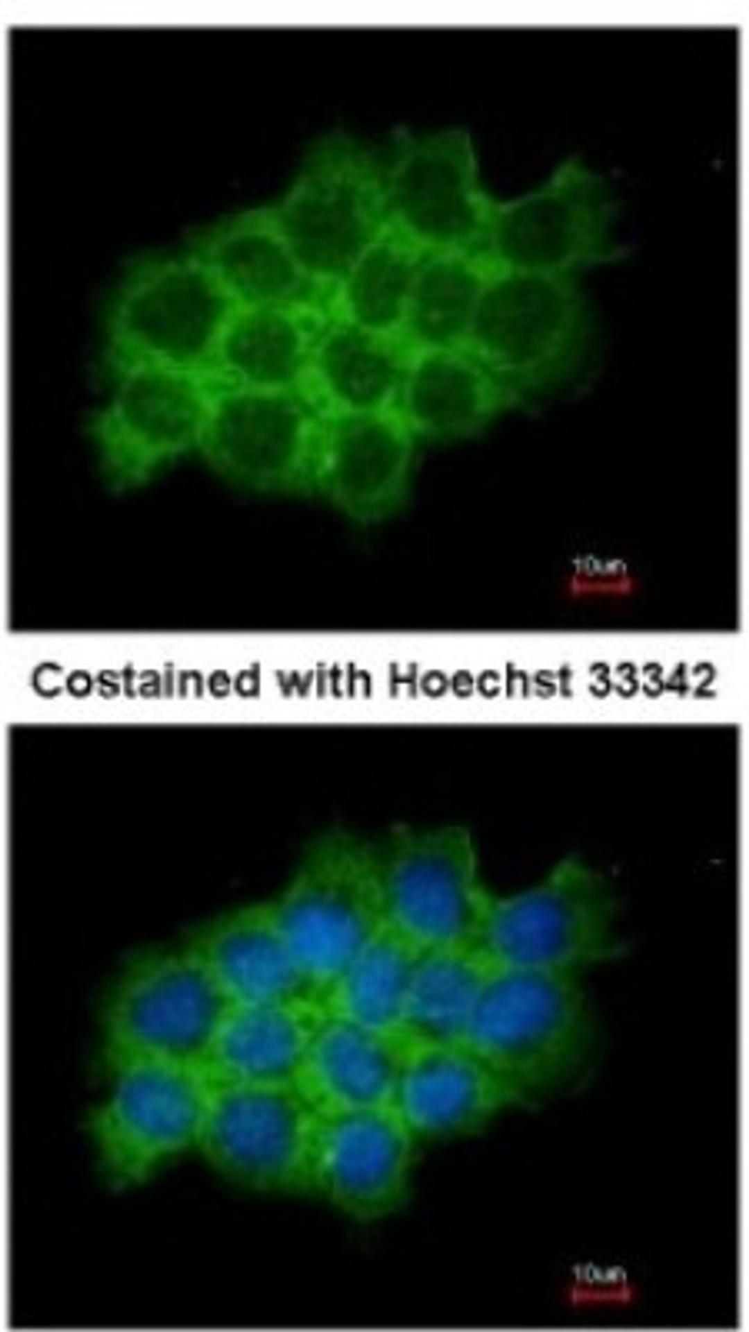 Immunocytochemistry/Immunofluorescence: SEC61A Antibody [NBP1-31267] - Analysis of methanol-fixed A431, using antibody at 1:200 dilution.