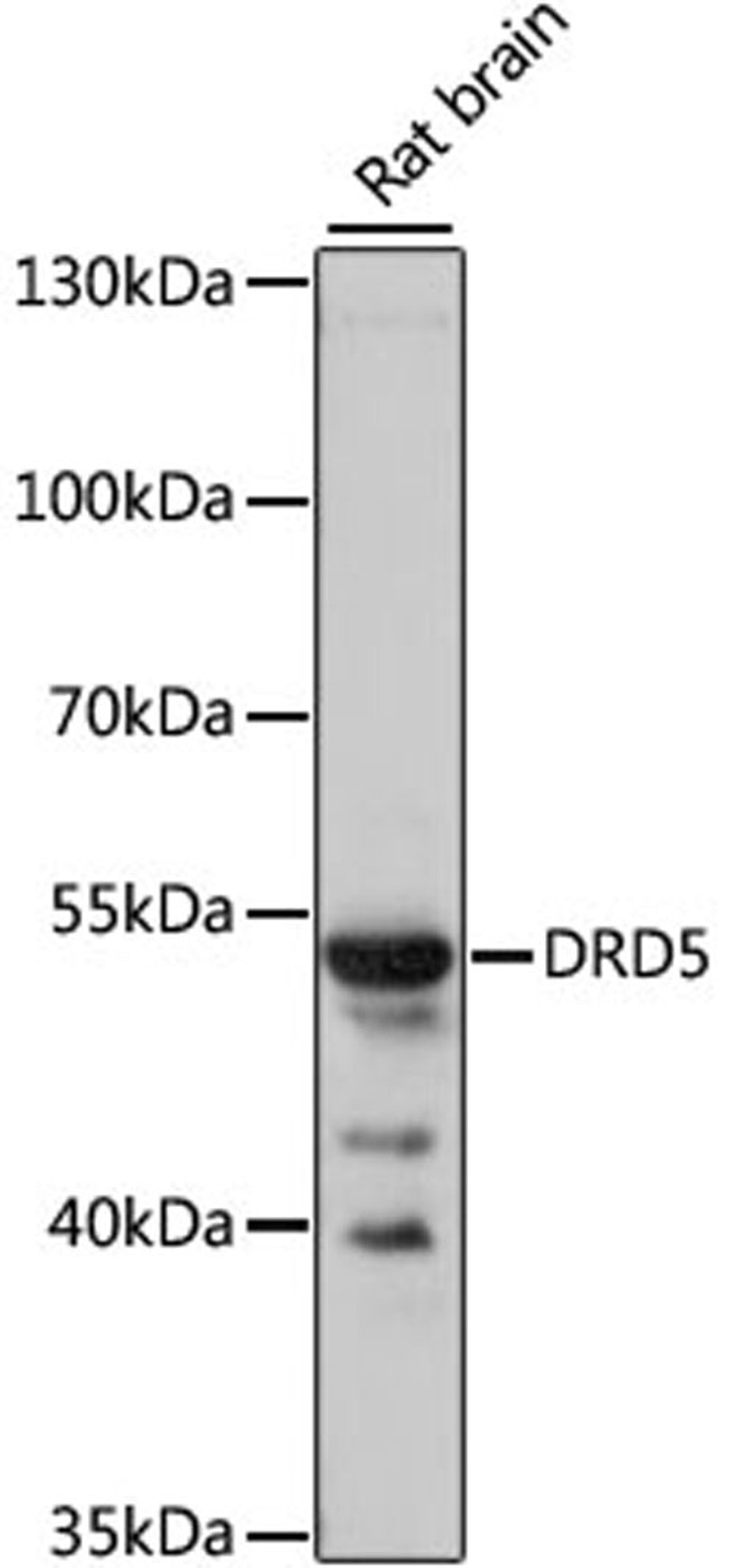 Western blot - DRD5 antibody (A3170)