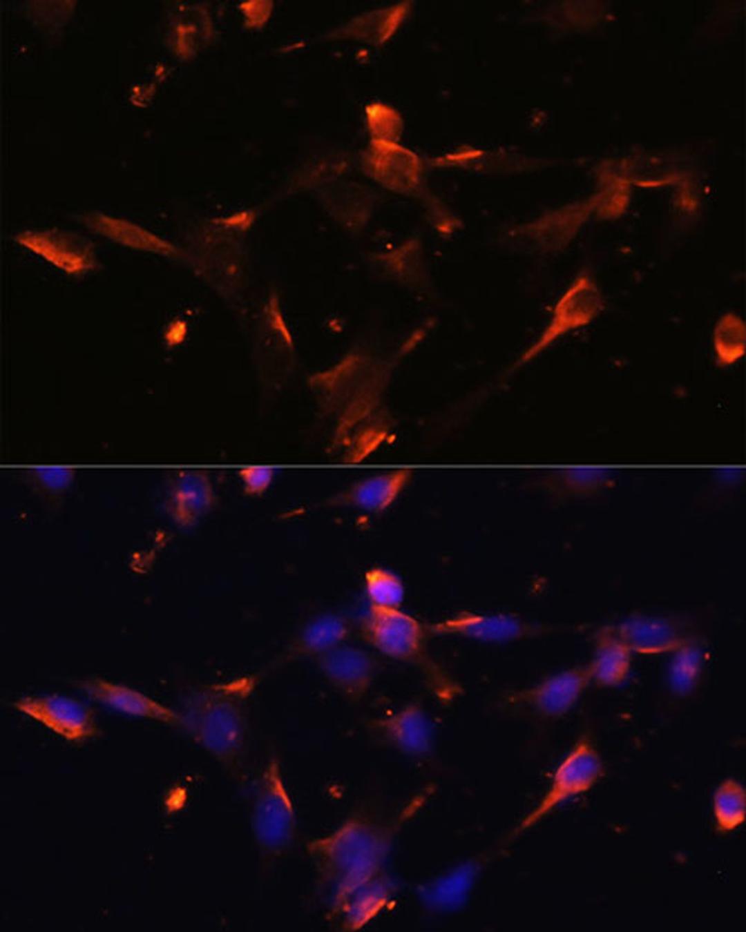 Immunofluorescence - CLDN5 antibody (A10207)