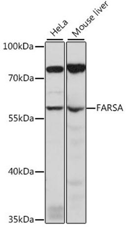 Western blot - FARSA antibody (A15670)